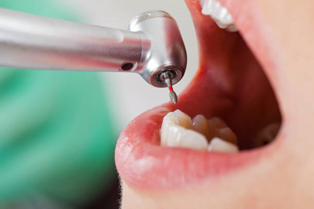 Best Emergency Dentist for Lost Fillings or Crowns in Westworth Village, TX